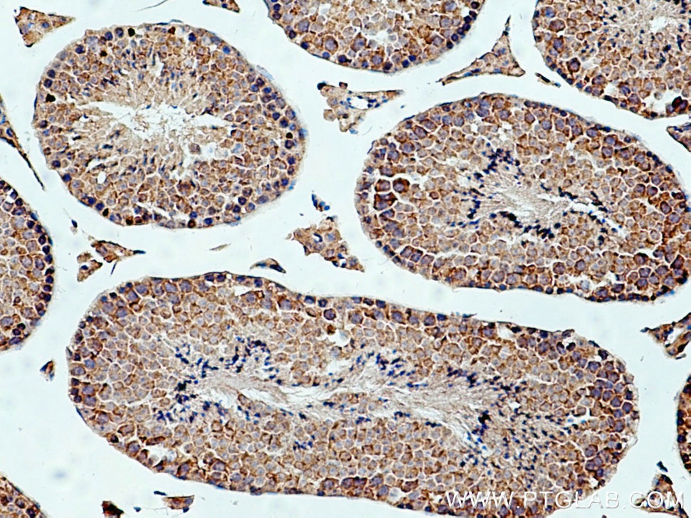 Immunohistochemistry (IHC) staining of mouse testis tissue using IFT172 Polyclonal antibody (28441-1-AP)