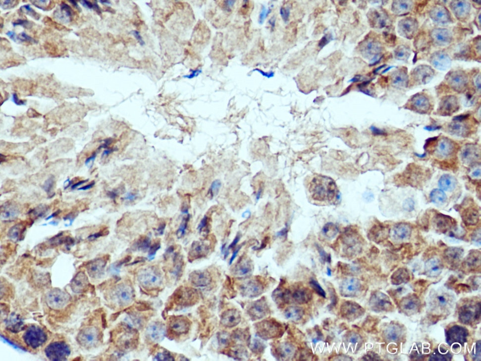 Immunohistochemistry (IHC) staining of mouse testis tissue using IFT172 Polyclonal antibody (28441-1-AP)