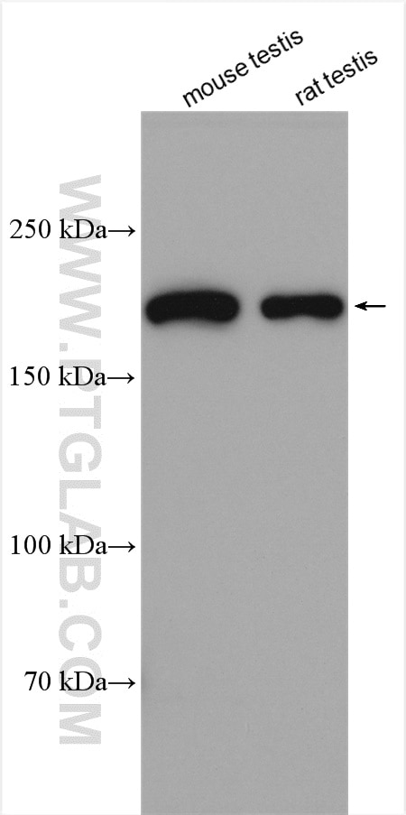 Western Blot (WB) analysis of various lysates using IFT172 Polyclonal antibody (28441-1-AP)