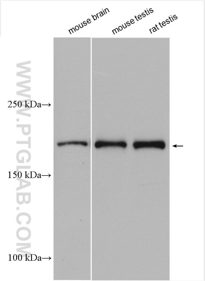 Western Blot (WB) analysis of various lysates using IFT172 Polyclonal antibody (28441-1-AP)