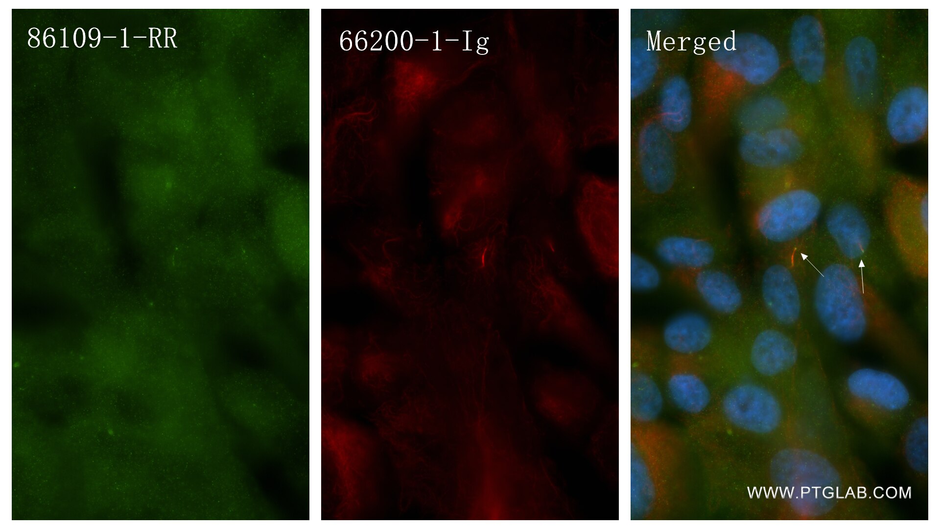 Immunofluorescence (IF) / fluorescent staining of hTERT-RPE1 cells using IFT172 Recombinant antibody (86109-1-RR)