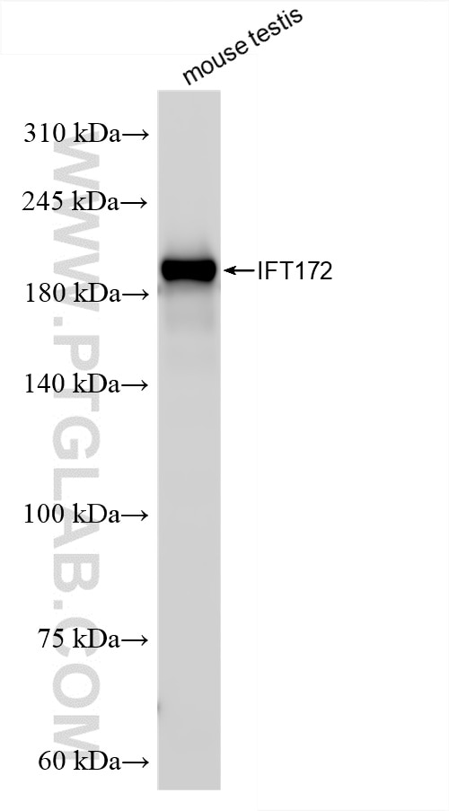Western Blot (WB) analysis of mouse testis tissue using IFT172 Recombinant antibody (86109-1-RR)