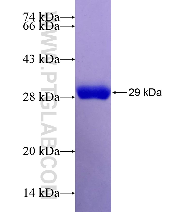 IFT172 fusion protein Ag27030 SDS-PAGE