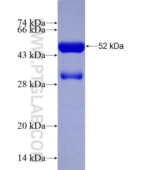 IFT172 fusion protein Ag28921 SDS-PAGE