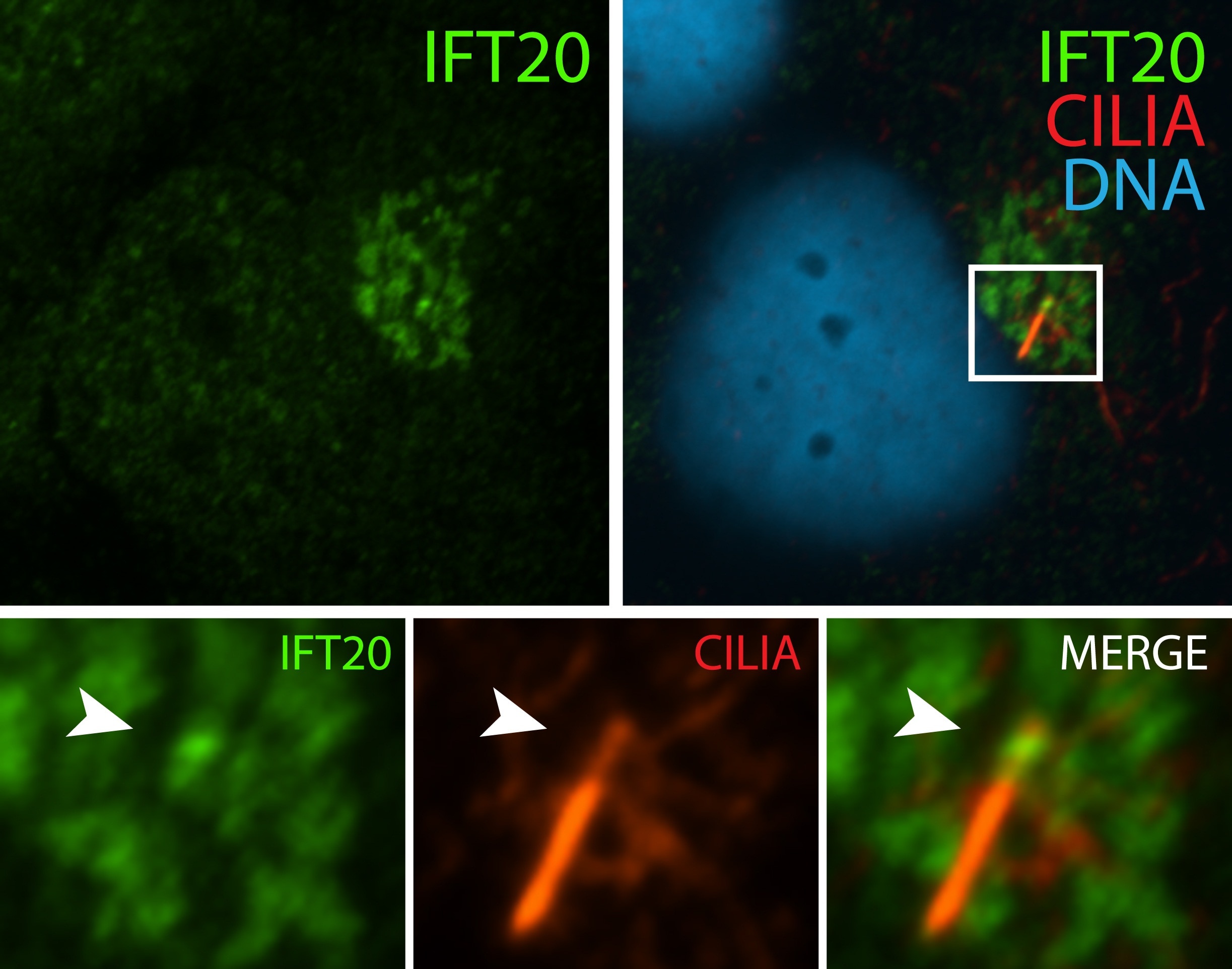 Immunofluorescence (IF) / fluorescent staining of hTERT-RPE1 cells using IFT20 Polyclonal antibody (13615-1-AP)