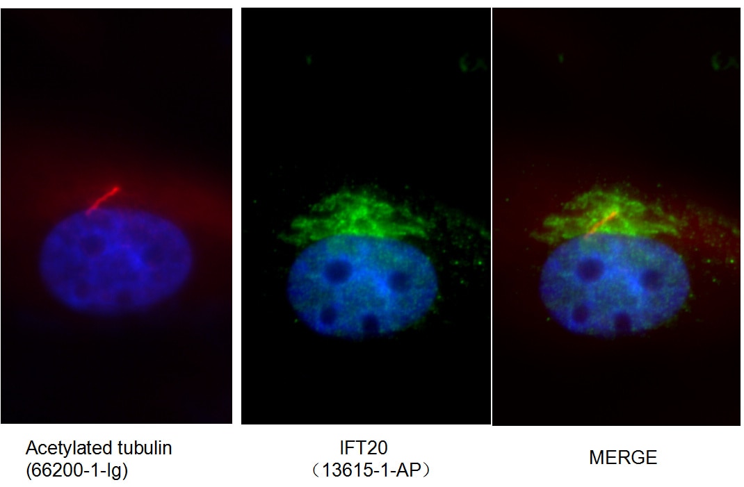 Immunofluorescence (IF) / fluorescent staining of MDCK cells using IFT20 Polyclonal antibody (13615-1-AP)