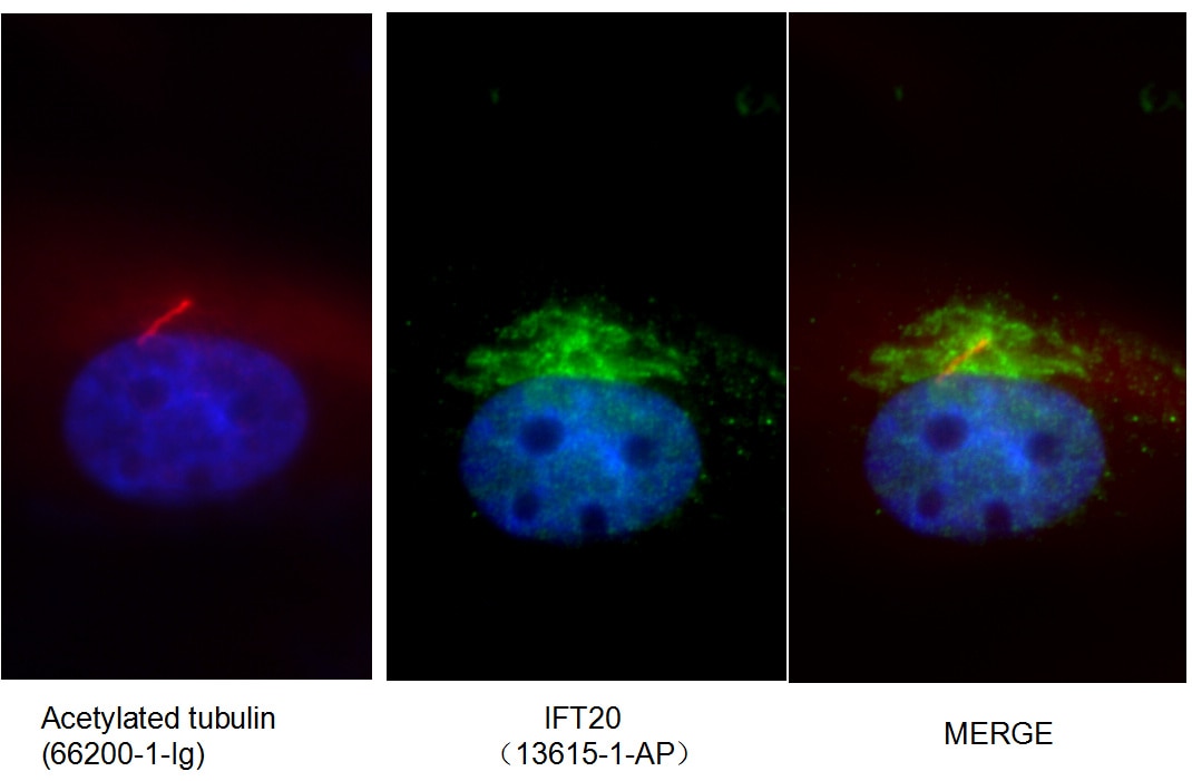 IF Staining of MDCK using 13615-1-AP