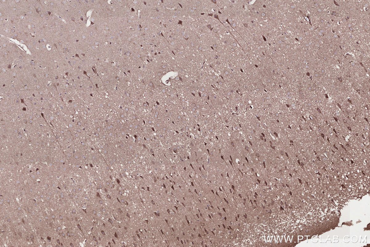 Immunohistochemistry (IHC) staining of mouse brain tissue using IFT20 Polyclonal antibody (13615-1-AP)