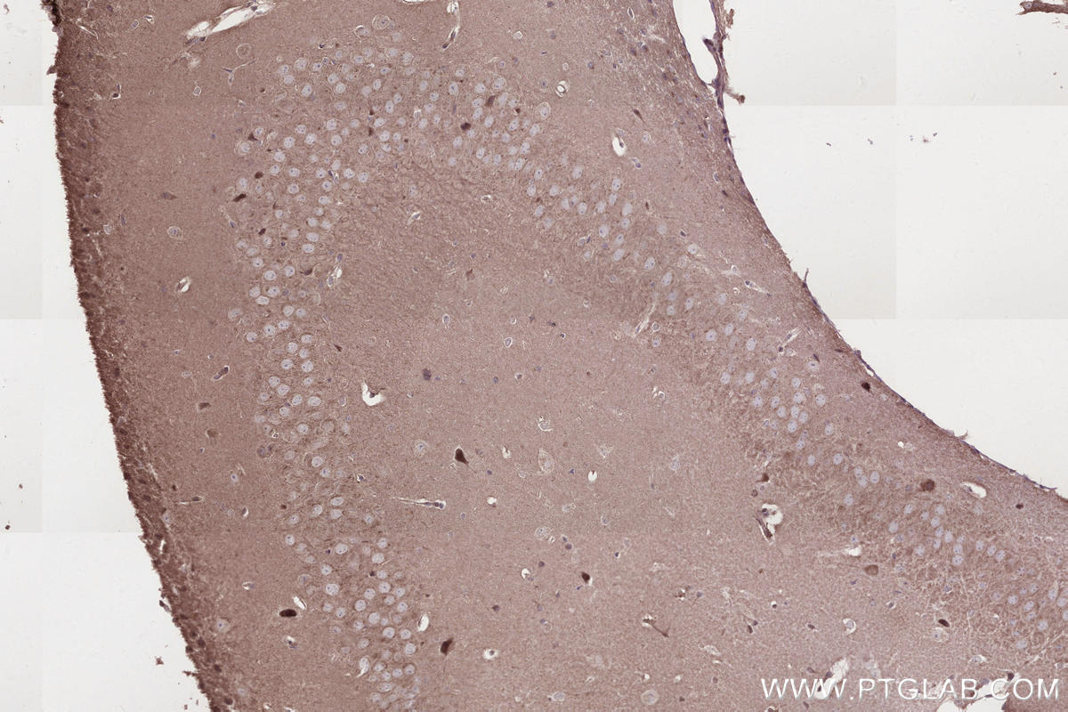 Immunohistochemistry (IHC) staining of mouse brain tissue using IFT20 Polyclonal antibody (13615-1-AP)