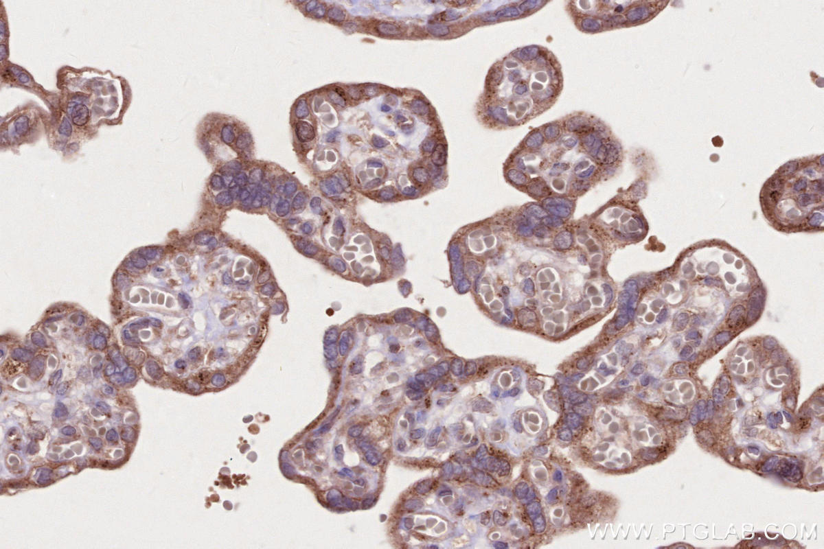 Immunohistochemistry (IHC) staining of human placenta tissue using IFT20 Polyclonal antibody (13615-1-AP)