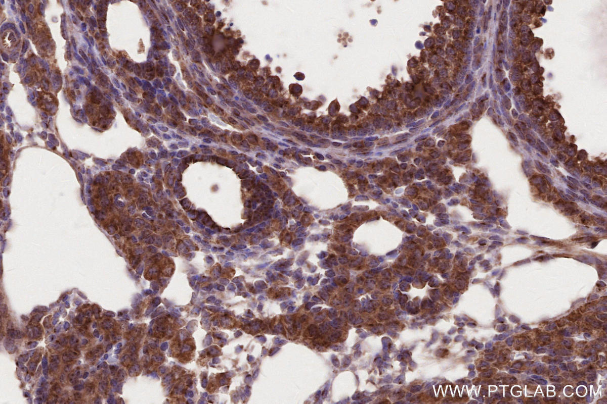 Immunohistochemistry (IHC) staining of mouse ovary tissue using IFT20 Polyclonal antibody (13615-1-AP)
