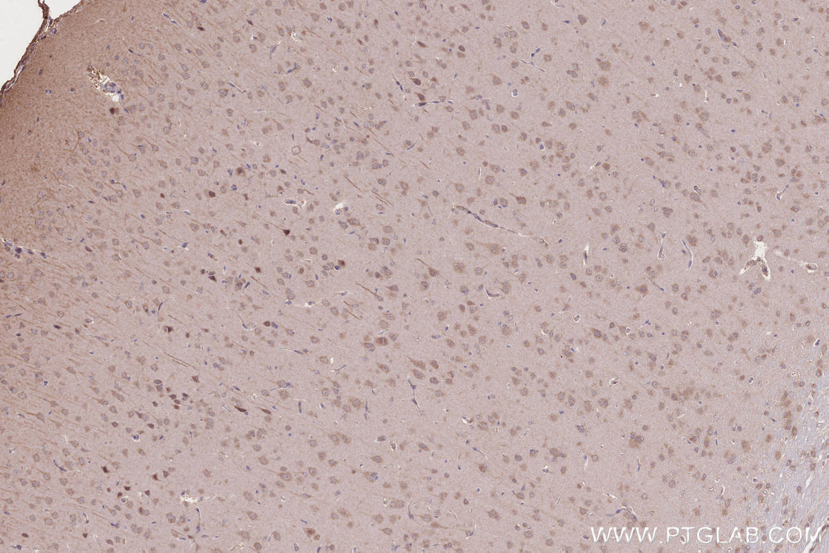 Immunohistochemistry (IHC) staining of rat brain tissue using IFT20 Polyclonal antibody (13615-1-AP)