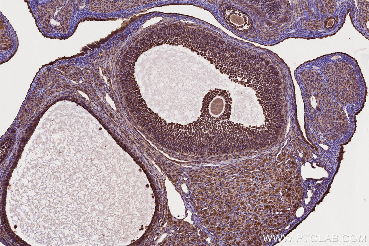 Immunohistochemistry (IHC) staining of rat ovary tissue using IFT20 Polyclonal antibody (13615-1-AP)