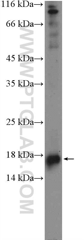 Western Blot (WB) analysis of MDCK cells using IFT20 Polyclonal antibody (13615-1-AP)