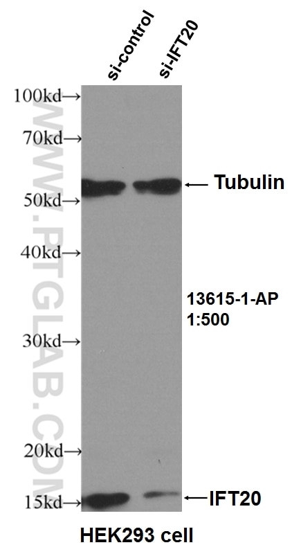 Western Blot (WB) analysis of HEK-293 cells using IFT20 Polyclonal antibody (13615-1-AP)