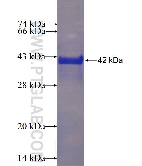 IFT20 fusion protein Ag4521 SDS-PAGE
