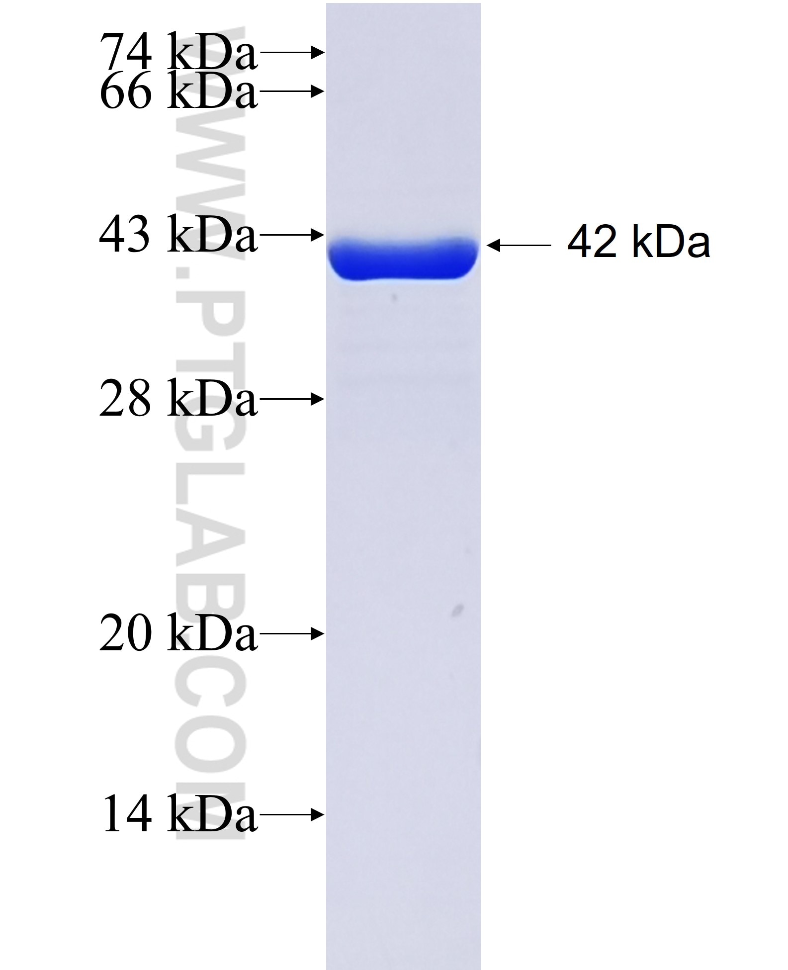 IFT20 fusion protein Ag4521 SDS-PAGE