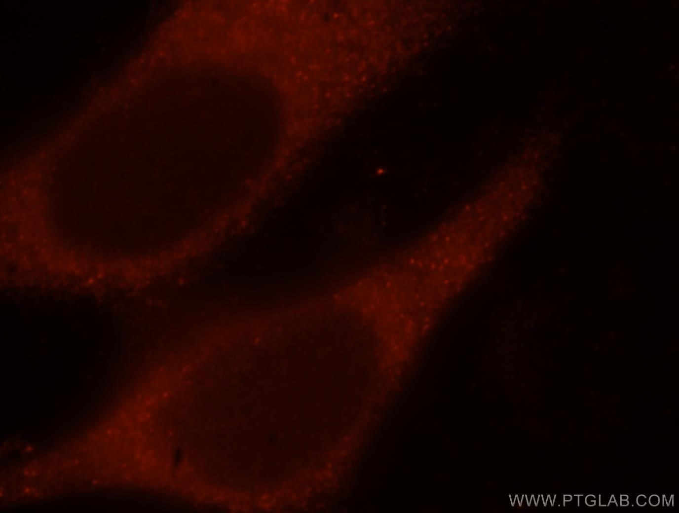 Immunofluorescence (IF) / fluorescent staining of HeLa cells using IFT52 Polyclonal antibody (17534-1-AP)