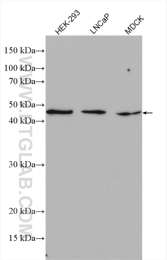 Western Blot (WB) analysis of various lysates using IFT52 Polyclonal antibody (17534-1-AP)