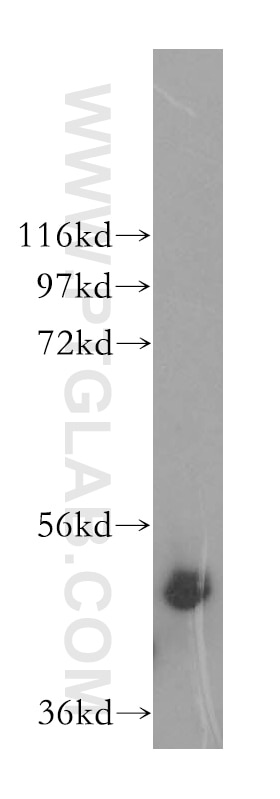 Western Blot (WB) analysis of human testis tissue using IFT52 Polyclonal antibody (17534-1-AP)