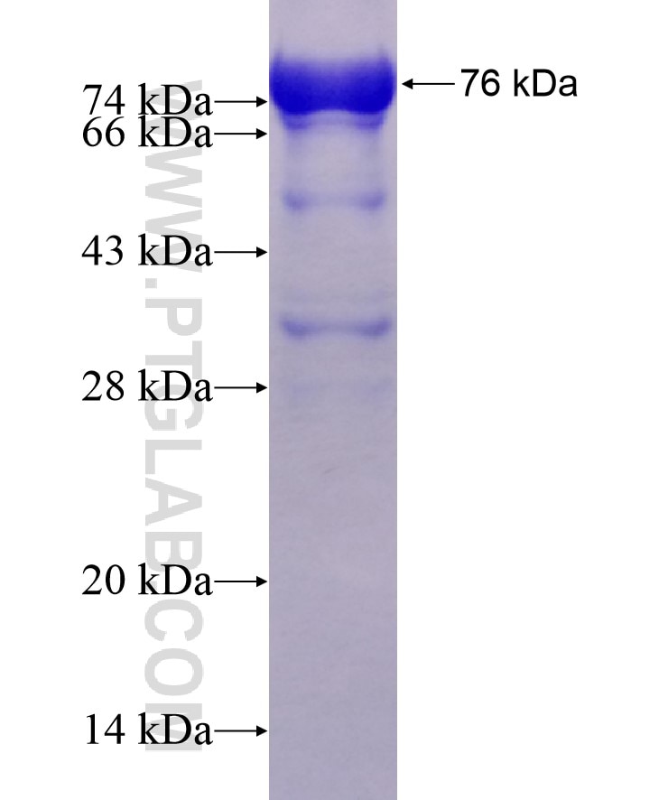 IFT52 fusion protein Ag11586 SDS-PAGE