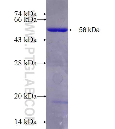 IFT52 fusion protein Ag11613 SDS-PAGE
