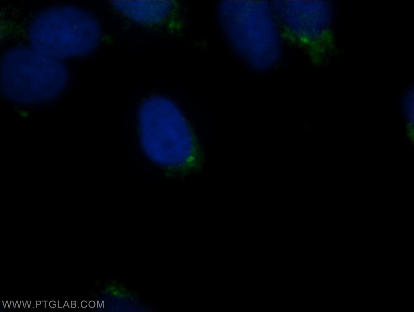 Immunofluorescence (IF) / fluorescent staining of MDCK cells using IFT57 Polyclonal antibody (11083-1-AP)