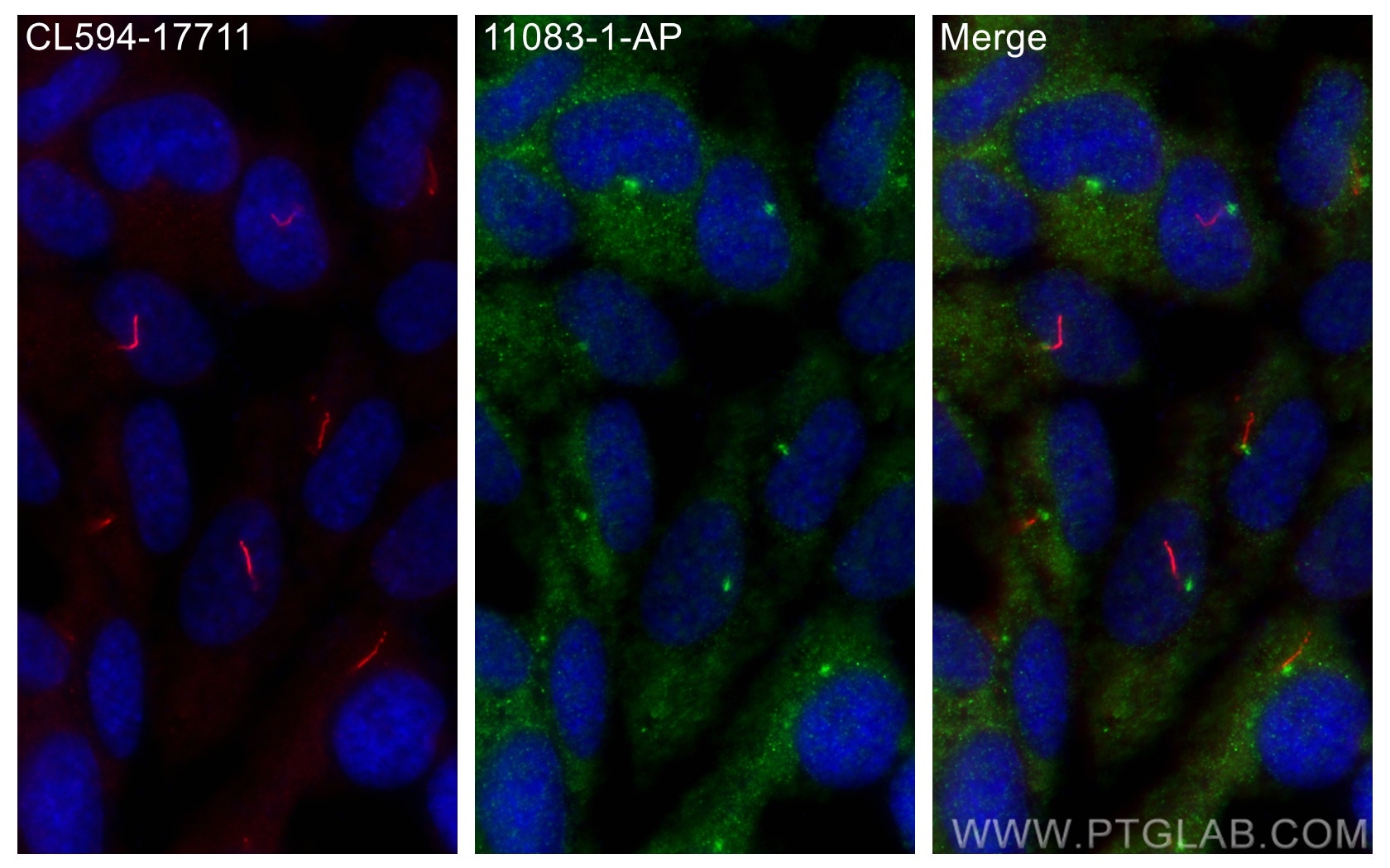 Immunofluorescence (IF) / fluorescent staining of hTERT-RPE1 cells using IFT57 Polyclonal antibody (11083-1-AP)