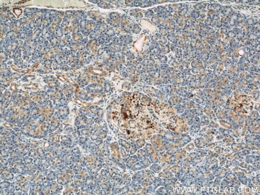 Immunohistochemistry (IHC) staining of human pancreas tissue using IFT57 Polyclonal antibody (11083-1-AP)