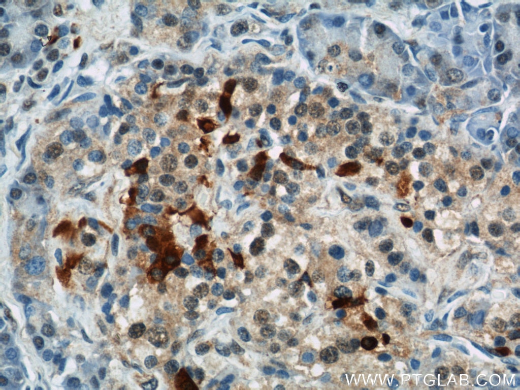 Immunohistochemistry (IHC) staining of human pancreas tissue using IFT57 Polyclonal antibody (11083-1-AP)