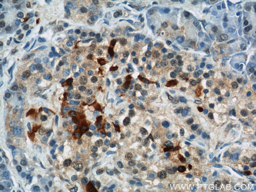 IHC staining of human pancreas using 11083-1-AP