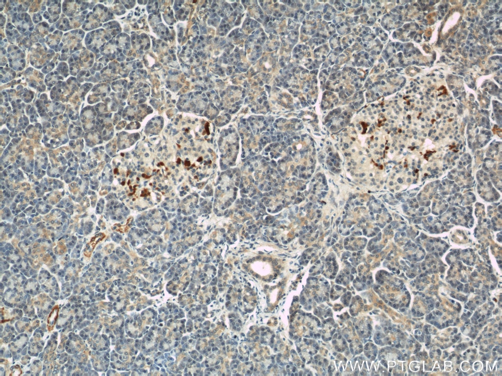 Immunohistochemistry (IHC) staining of human pancreas tissue using IFT57 Polyclonal antibody (11083-1-AP)