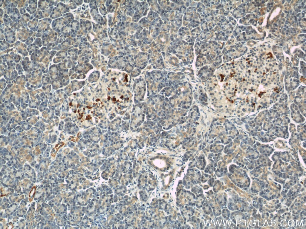 IHC staining of human pancreas using 11083-1-AP