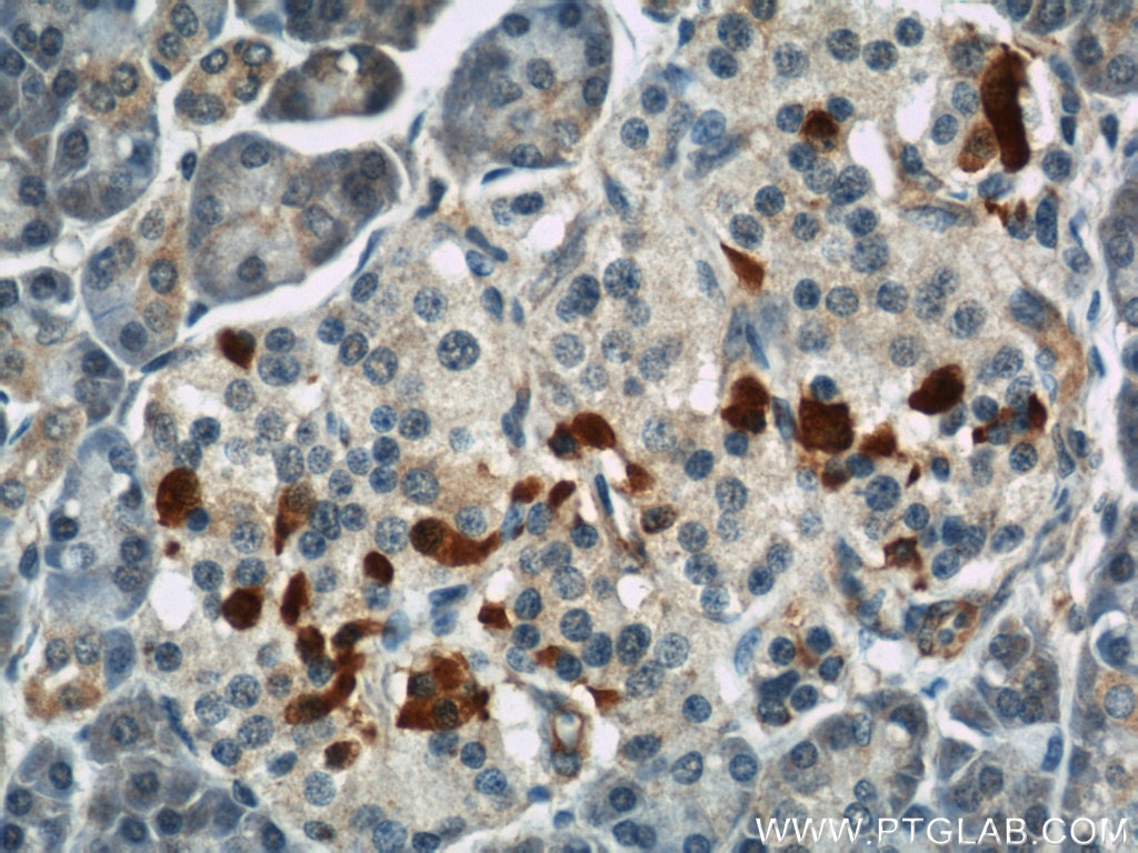 Immunohistochemistry (IHC) staining of human pancreas tissue using IFT57 Polyclonal antibody (11083-1-AP)