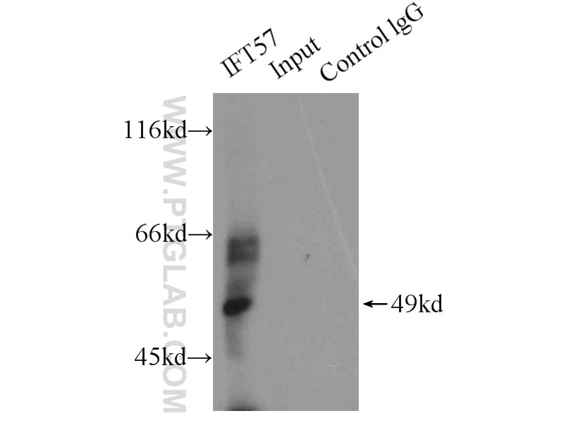 Immunoprecipitation (IP) experiment of HEK-293 cells using IFT57 Polyclonal antibody (11083-1-AP)