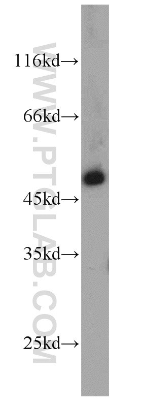 Western Blot (WB) analysis of mouse retina tissue using IFT57 Polyclonal antibody (11083-1-AP)