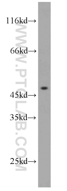 Western Blot (WB) analysis of HEK-293 cells using IFT57 Polyclonal antibody (11083-1-AP)