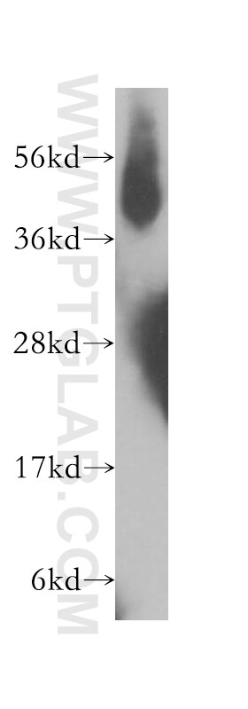 Western Blot (WB) analysis of HEK-293 cells using IFT57 Polyclonal antibody (11083-1-AP)