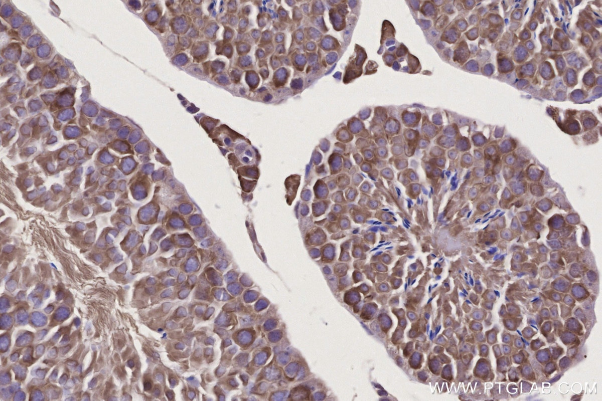 IHC staining of mouse testis using 27334-1-AP Immunohistochemistry (IHC) staining of mouse testis tissue using IFT74 Polyclonal antibody (27334-1-AP)