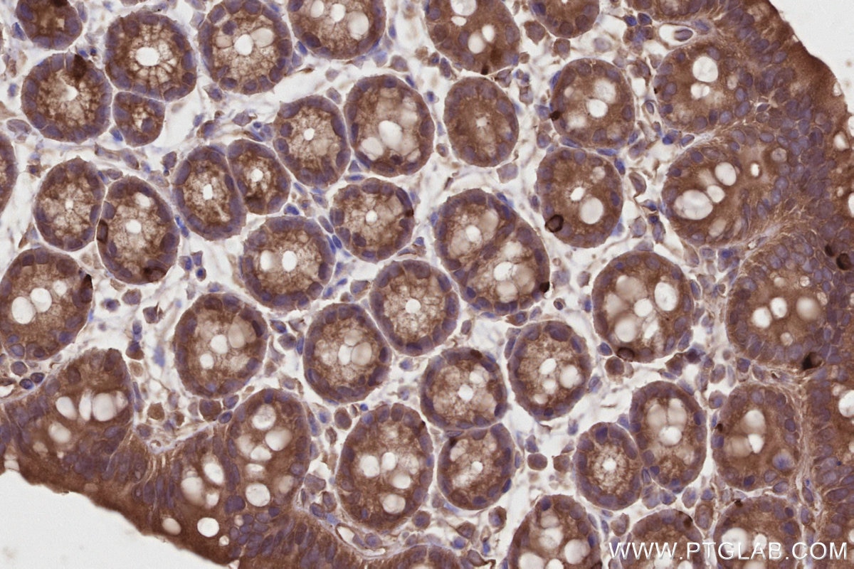 IHC staining of mouse colon using 27334-1-AP Immunohistochemistry (IHC) staining of mouse colon tissue using IFT74 Polyclonal antibody (27334-1-AP)