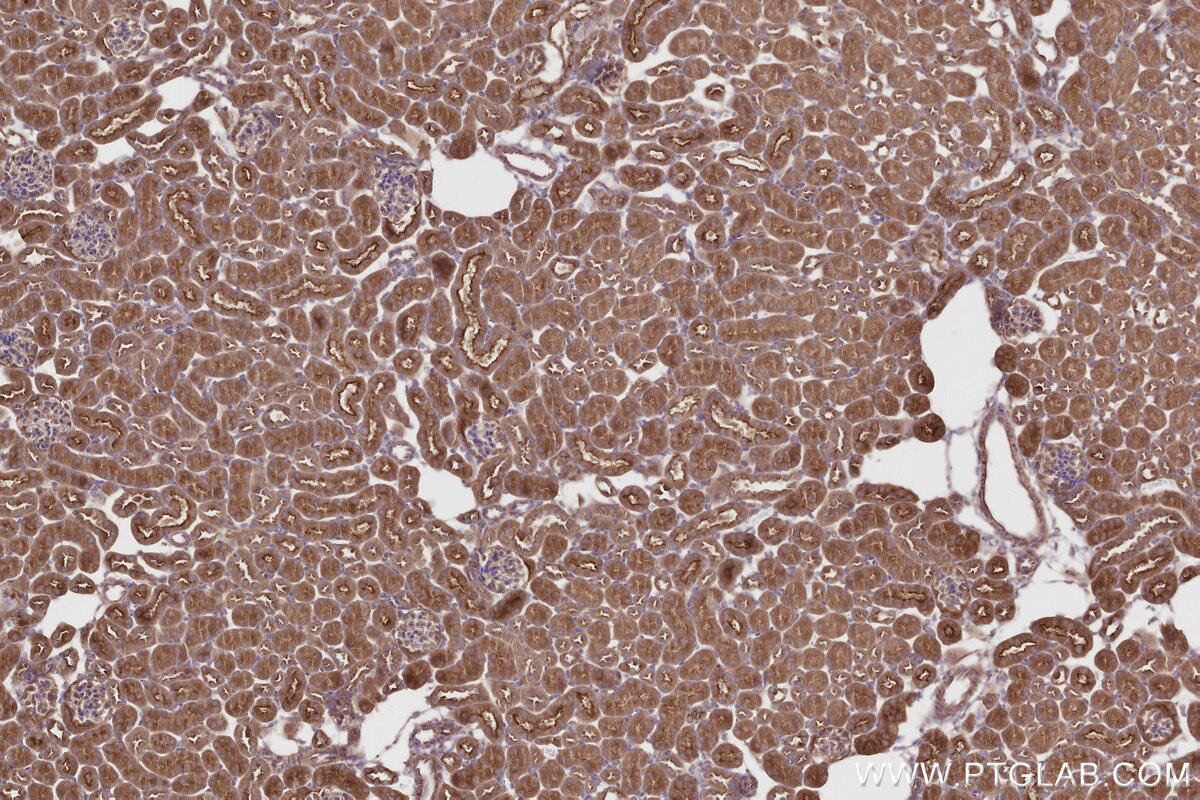 IHC staining of mouse kidney using 27334-1-AP Immunohistochemistry (IHC) staining of mouse kidney tissue using IFT74 Polyclonal antibody (27334-1-AP)