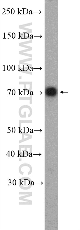 Western Blot (WB) analysis of Jurkat cells using IFT74 Polyclonal antibody (27334-1-AP)