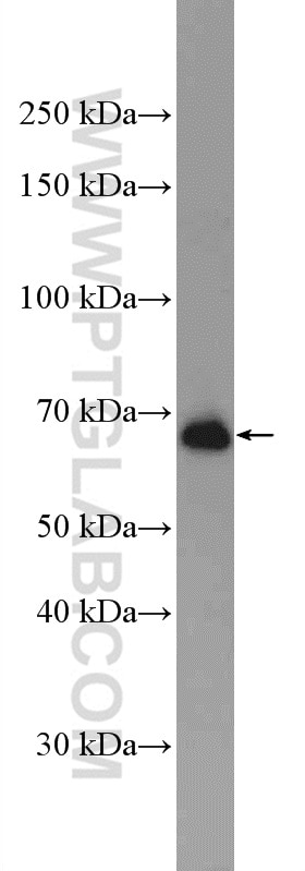 Western Blot (WB) analysis of Raji cells using IFT74 Polyclonal antibody (27334-1-AP)