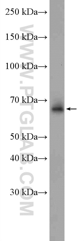 Western Blot (WB) analysis of mouse thymus tissue using IFT74 Polyclonal antibody (27334-1-AP)