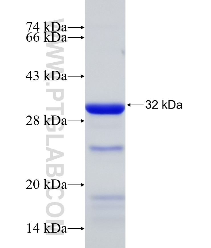 IFT74 fusion protein Ag26348 SDS-PAGE