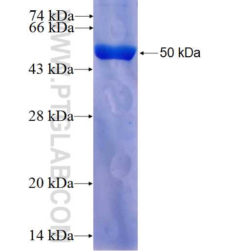 IFT74 fusion protein Ag26385 SDS-PAGE