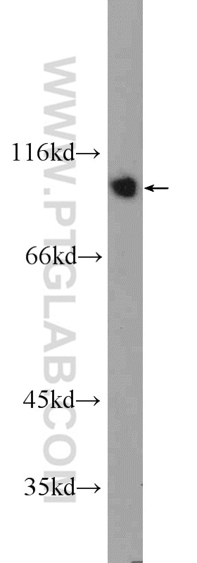 Western Blot (WB) analysis of mouse kidney tissue using IFT80 Polyclonal antibody (25230-1-AP)