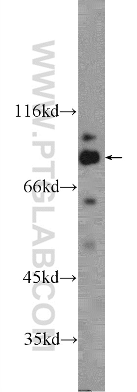Western Blot (WB) analysis of mouse brain tissue using IFT80 Polyclonal antibody (25230-1-AP)