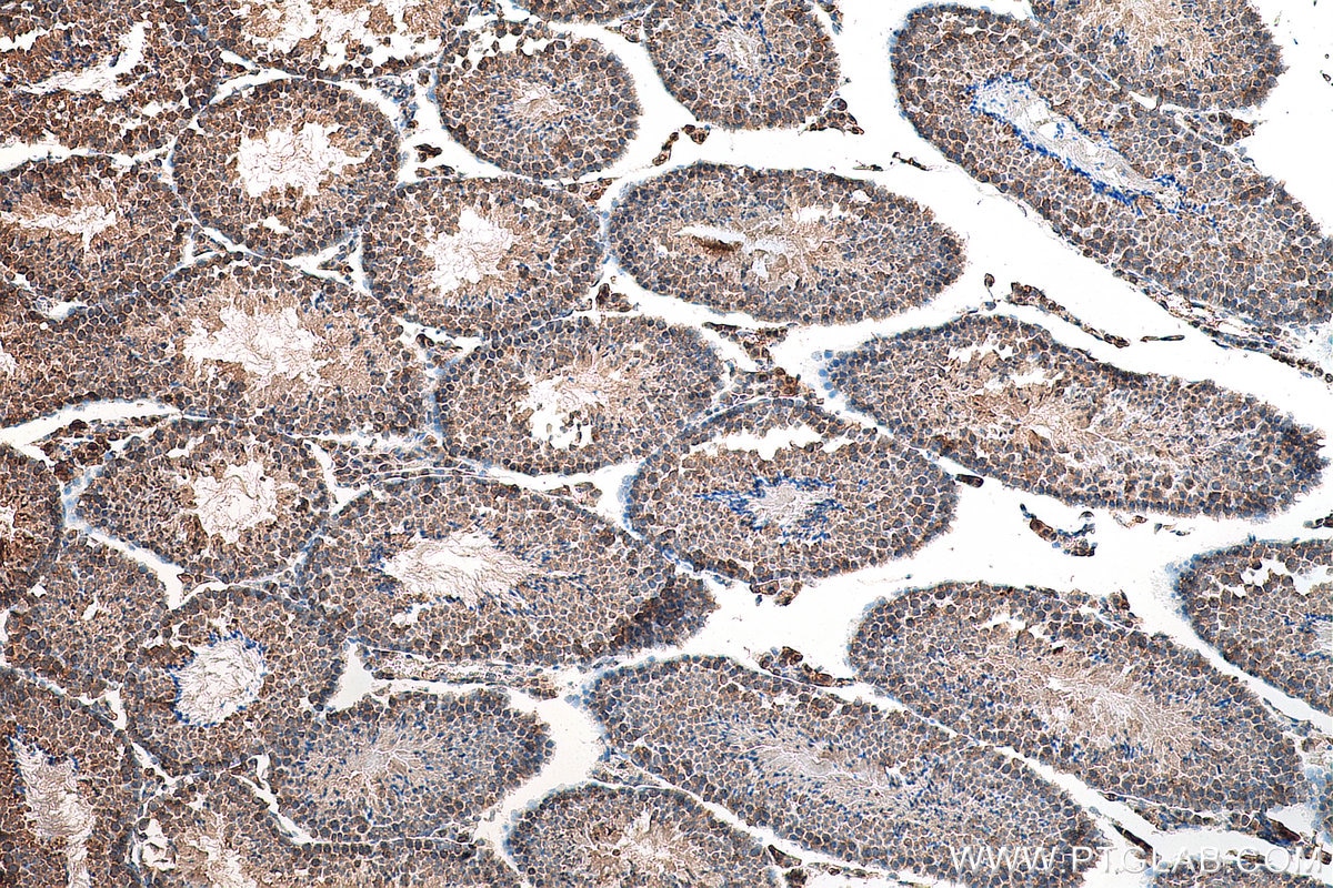 Immunohistochemistry (IHC) staining of mouse testis tissue using IFT81 Polyclonal antibody (10604-2-AP)