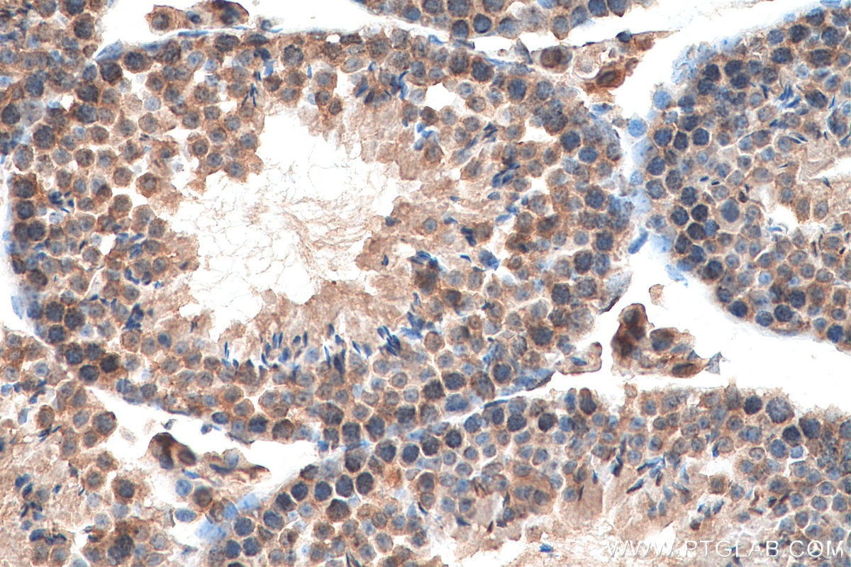 Immunohistochemistry (IHC) staining of mouse testis tissue using IFT81 Polyclonal antibody (10604-2-AP)